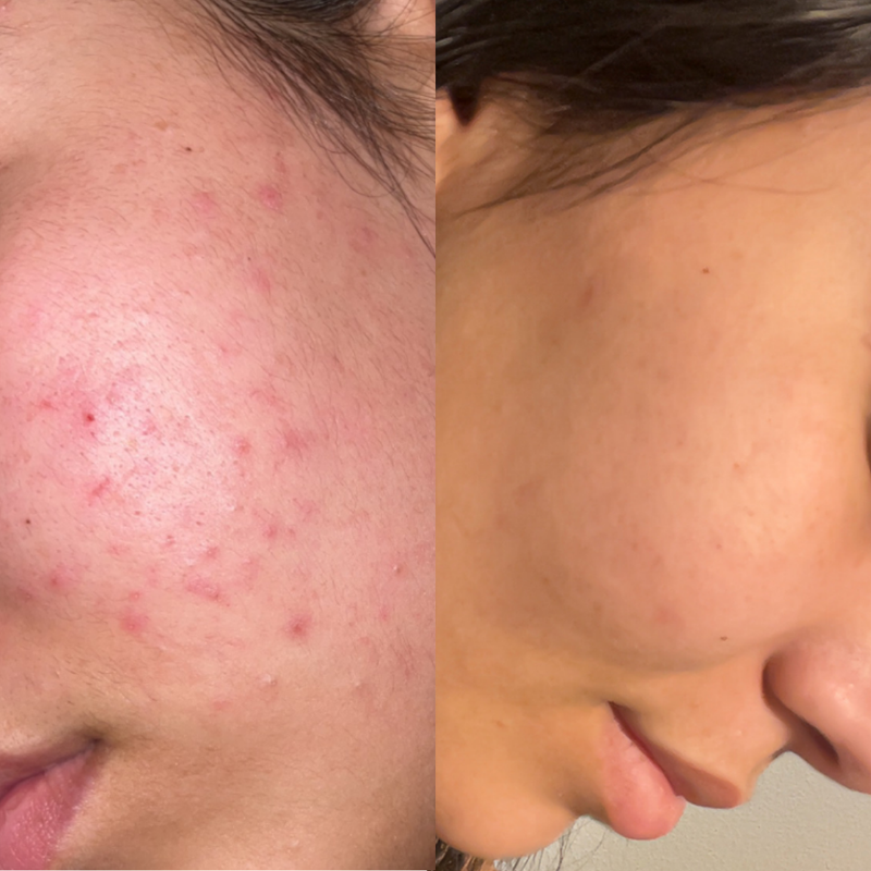 Adieu rougeurs, bonjour peau apaisée