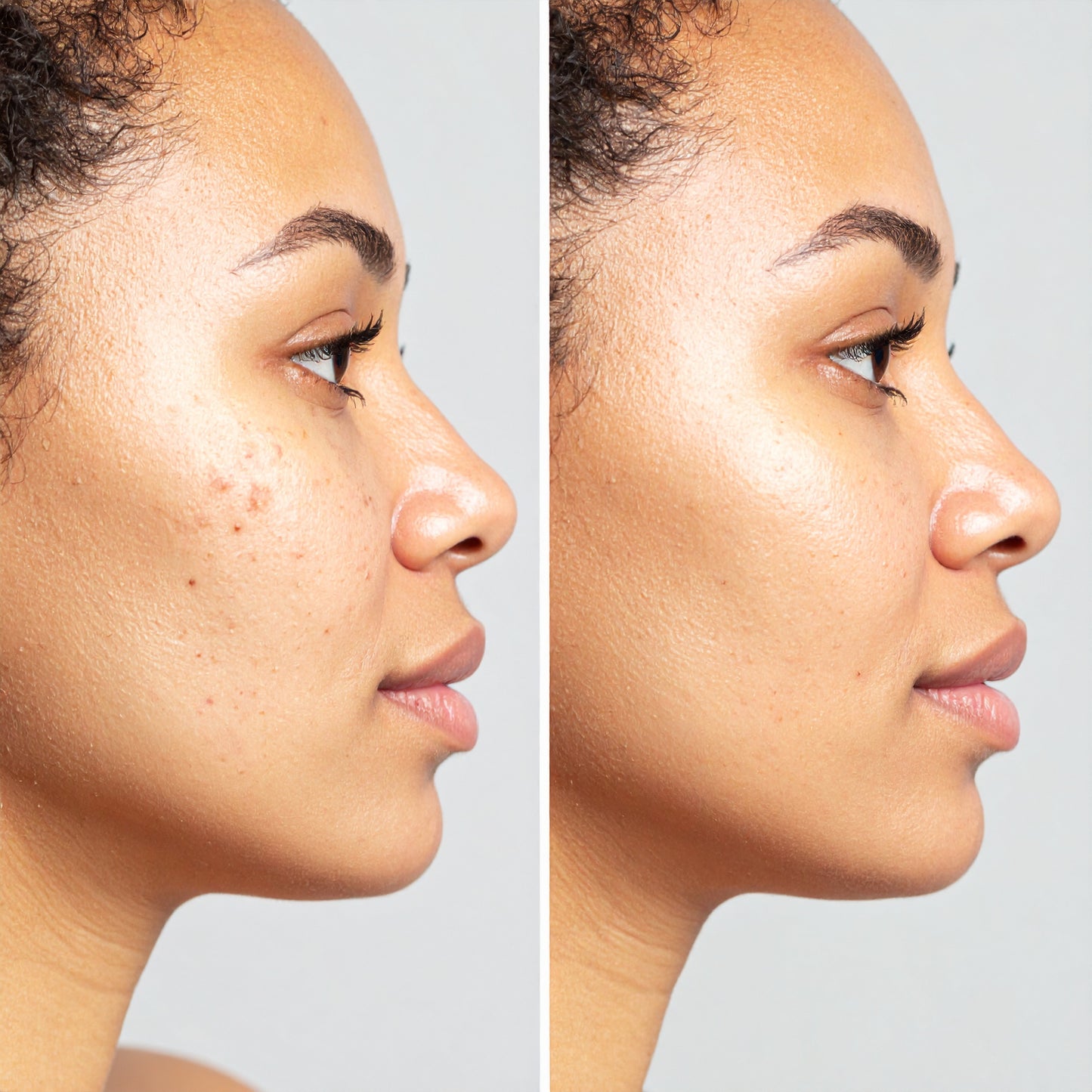 Coffret - Anti-Hyperpigmentation