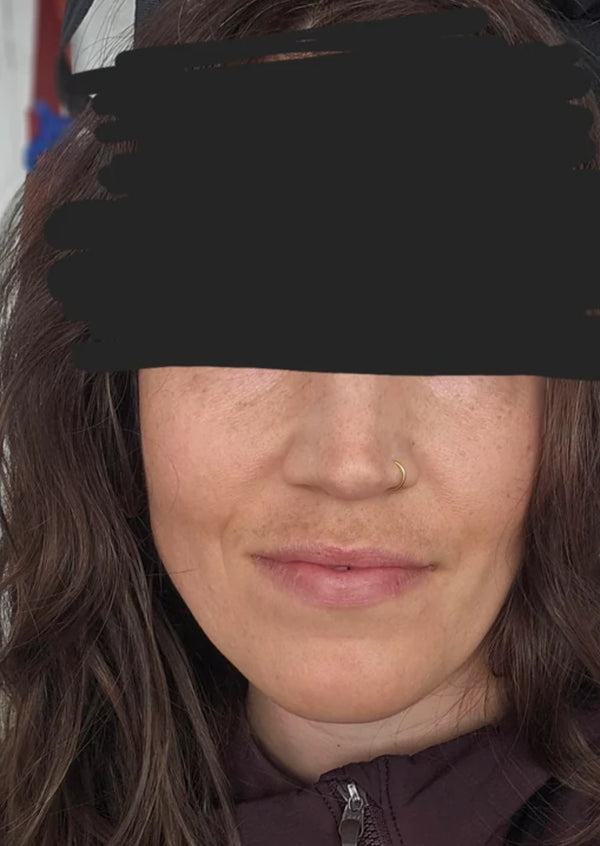 Before — Sarah