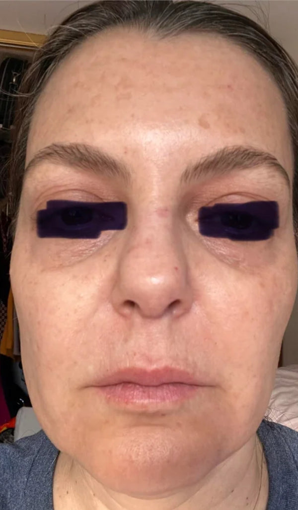 After — Carine