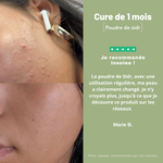 The Anti-Blemish Ritual with Sidr